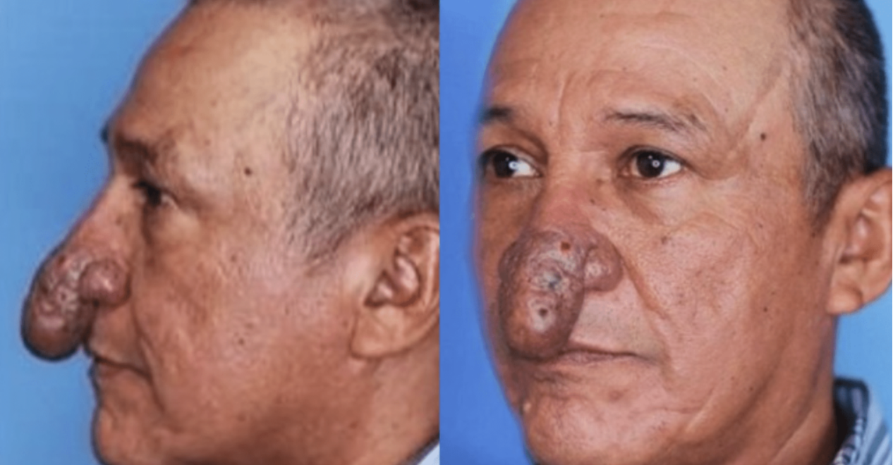 Conrado’s Incredible Transformation: Reshaping Lives with Plastic Surgery