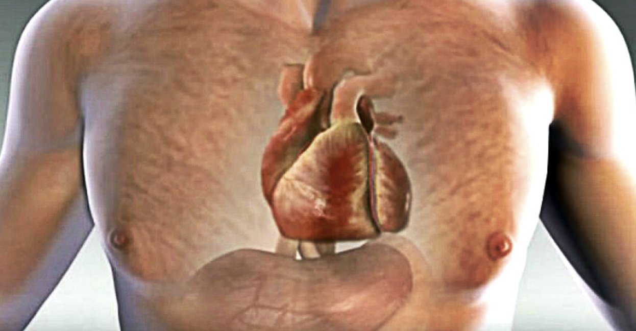 Signs Your Body May Warn You of an Impending Heart Attack