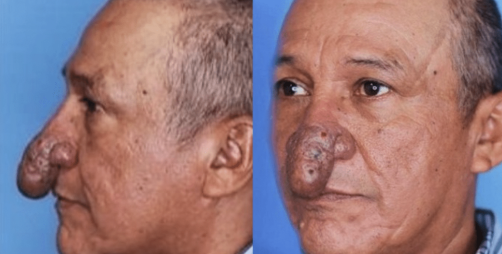 Conrado’s Remarkable Transformation: Reshaping Lives Through Plastic Surgery